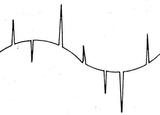 Figura 5 - Pulsos sobrepuestos a una señal senoidal (transitorios)
Figura 5 - Pulsos sobrepuestos a una señal senoidal (transitorios)