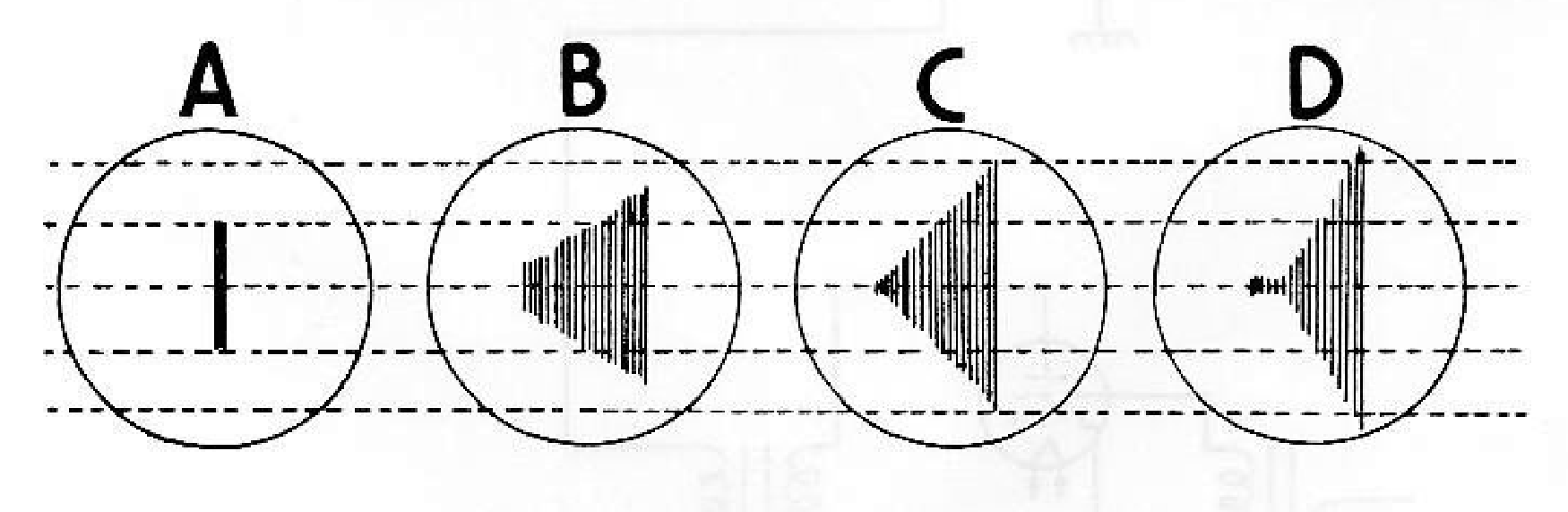 Figura 3 - Onda portadora analizada en osciloscopio; A -sin modulación; B -com 80 por ciento de modulación; C -com 100 por ciento de modulación; D -con exceso de modulación. A - Portadora no modulada B - Portadora modulada a 80% C - Portadora modulada al 100% D - Portadora modulada supermodulada.
Figura 3 - Onda portadora analizada en osciloscopio; A -sin modulación; B -com 80 por ciento de modulación; C -com 100 por ciento de modulación; D -con exceso de modulación. A - Portadora no modulada B - Portadora modulada a 80% C - Portadora modulada al 100% D - Portadora modulada supermodulada.